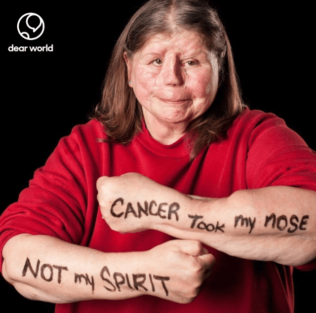 Sue Brain Tattoo portrait, University of Nebraska — Cancer took my nose not my spirit